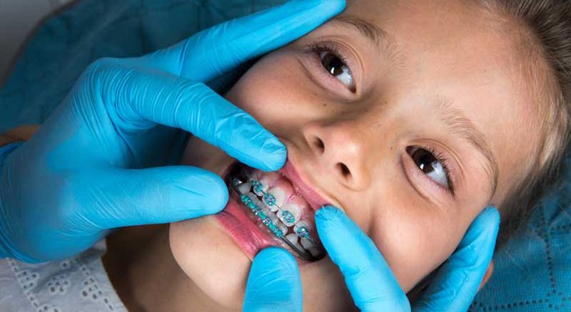 کلینیک ارتودنسی کودکان در تهران