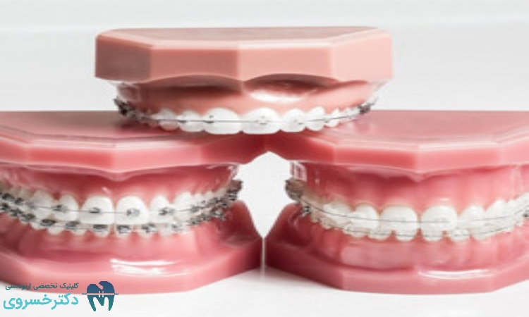 معیارهای زیبایی در تشخیص ارتودنسی