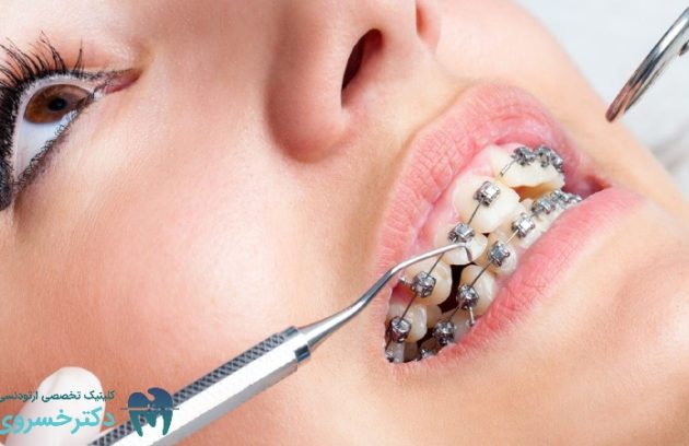 تشخیص ارتودنسی به صورت فردی