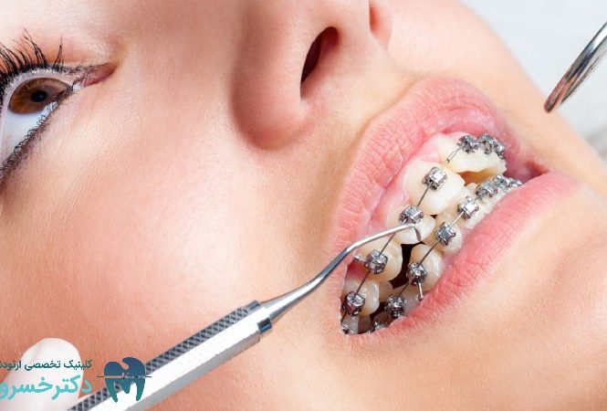 تشخیص ارتودنسی به‌ صورت فردی