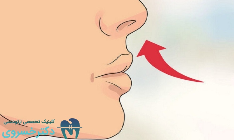 ارتودنسی و تاثیر آن بر آپنه خواب در کودکان