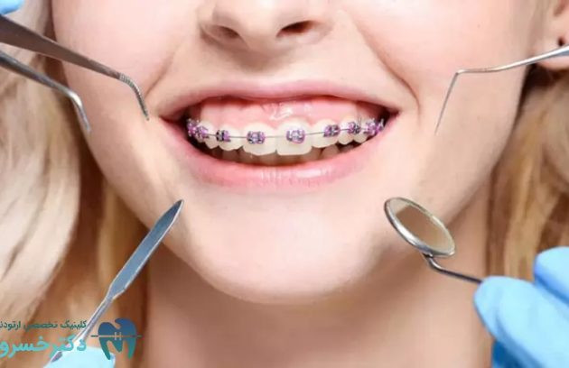 بررسی دقیق تأثیر ارتودنسی بر مشکلات تنفسی و خواب