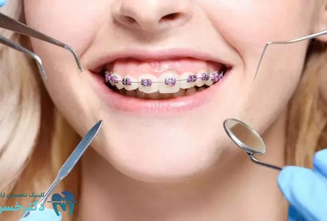 بررسی دقیق تأثیر ارتودنسی بر مشکلات تنفسی و خواب