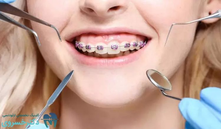 بررسی دقیق تأثیر ارتودنسی بر مشکلات تنفسی و خواب