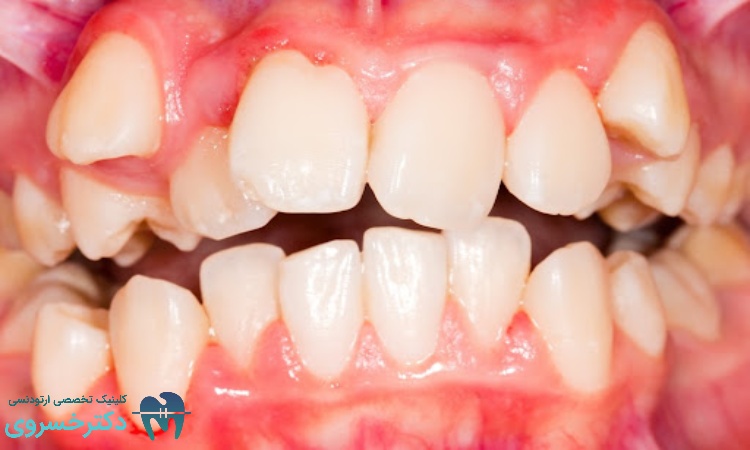 تشخیص درمان ارتودنسی