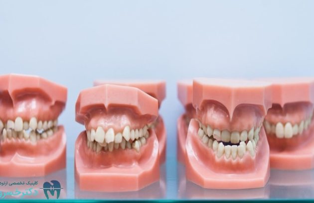 تشخیص ارتودنسی و اهمیت آن در درمان ناهنجاری‌های دندانی