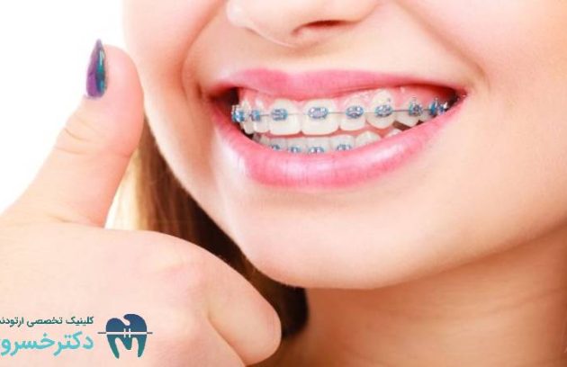 ۱۰ نکته کلیدی برای موفقیت در درمان های ارتودنسی ترکیبی