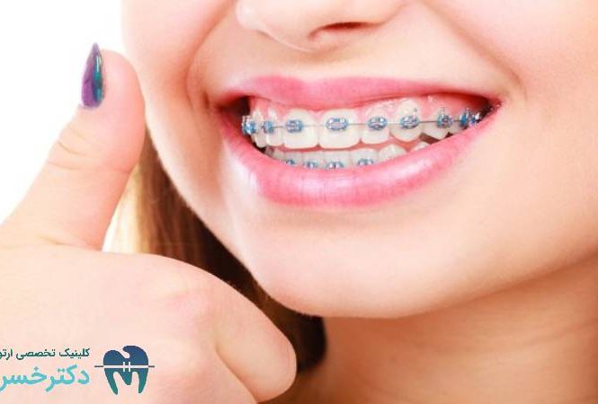 ۱۰ نکته کلیدی برای موفقیت در درمان ‌های ارتودنسی ترکیبی