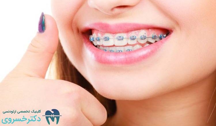 ۱۰ نکته کلیدی برای موفقیت در درمان ‌های ارتودنسی ترکیبی