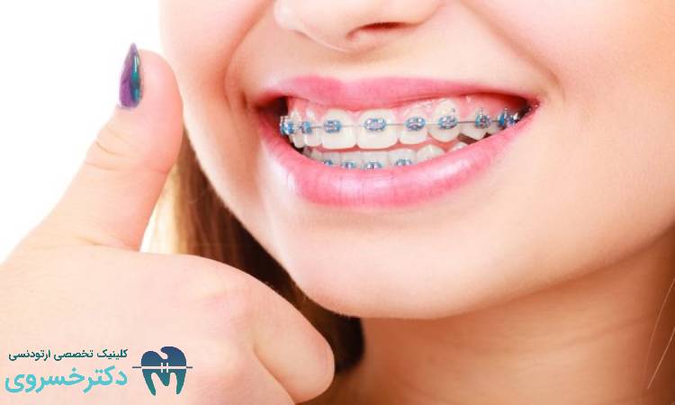 ۱۰ نکته کلیدی برای موفقیت در درمان ‌های ارتودنسی ترکیبی