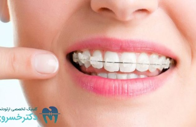 اهمیت تعیین اهداف واقع بینانه در درمان های ارتودنسی