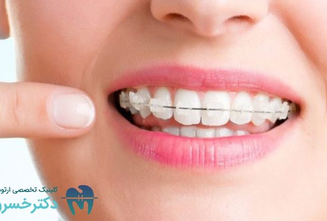 اهمیت تعیین اهداف واقع ‌بینانه در درمان ‌های ارتودنسی