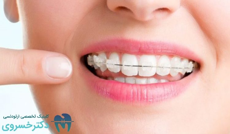 اهمیت تعیین اهداف واقع بینانه در درمان های ارتودنسی