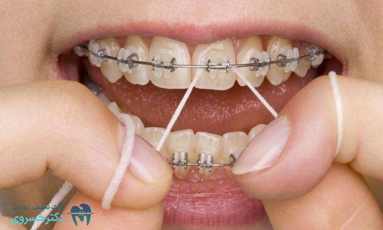 بهداشت دهان و دندان