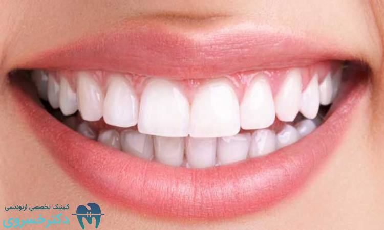 طراحی لبخند زیبا