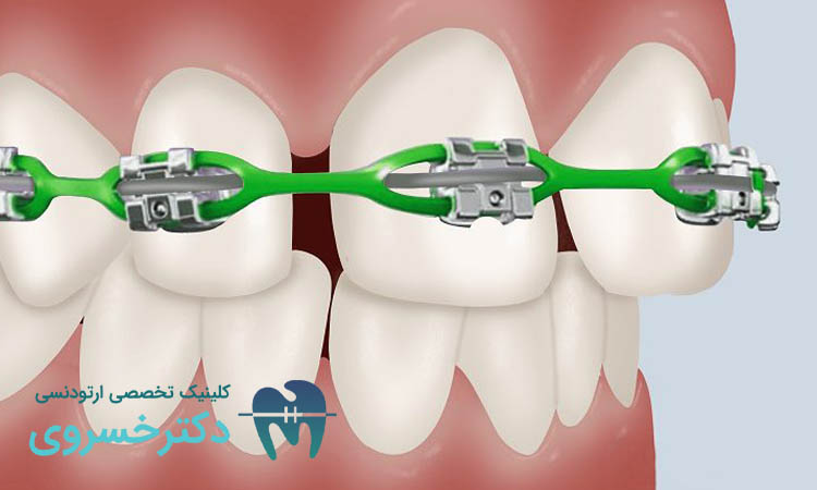 ارتودنسی و تکنولوژیهای نوین
