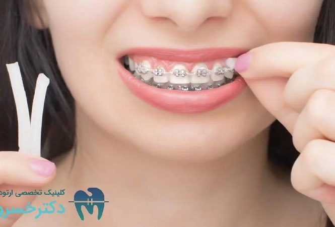 ارزیابی زیبایی در ارتودنسی از دیدگاه بیمار و دندانپزشک