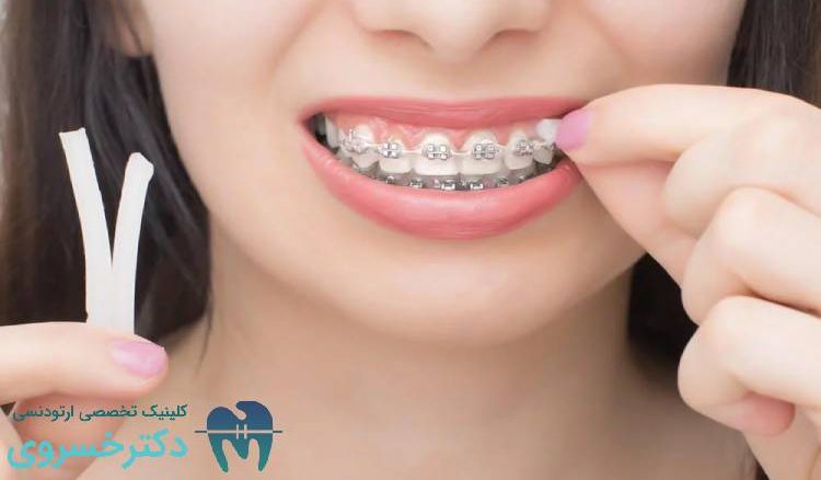 ارزیابی زیبایی در ارتودنسی از دیدگاه بیمار و دندانپزشک