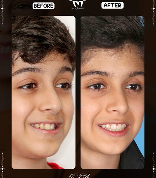 بررسی قبل و بعد ارتودنسی