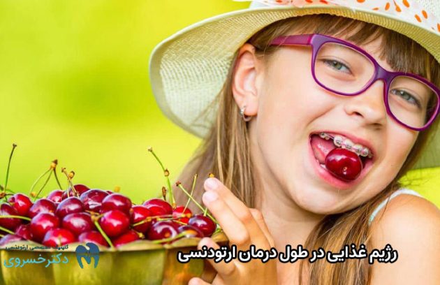 رژیم غذایی در زمان ارتودنسی