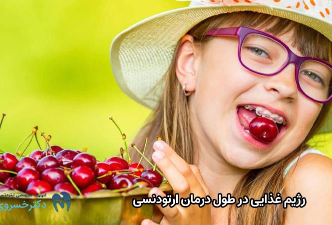 رژیم غذایی در زمان ارتودنسی