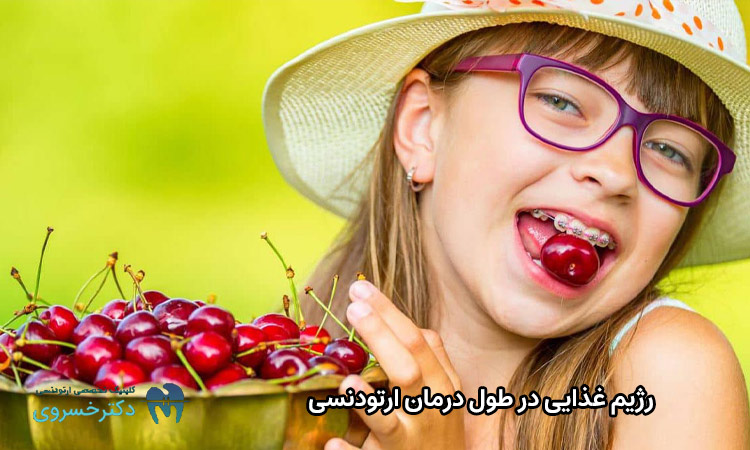 رژیم غذایی در زمان ارتودنسی