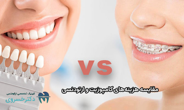 تفاوت هزینههای کامپوزیت و ارتودنسی