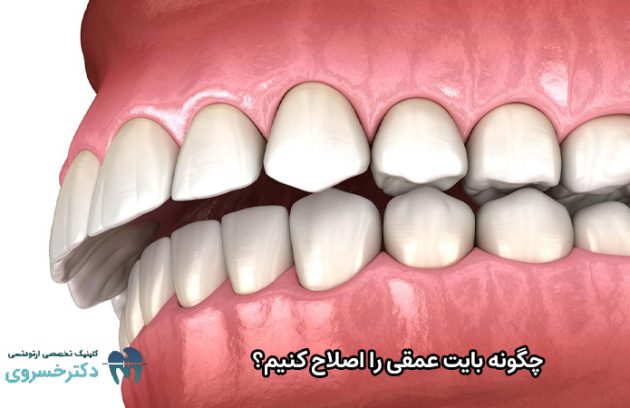 اصلاح بایت عمقی