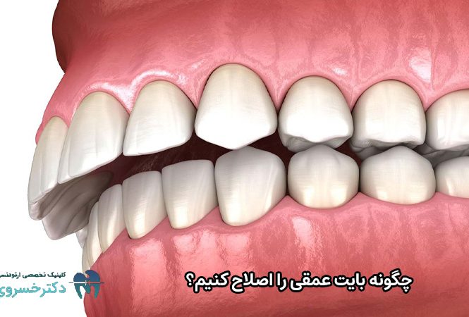 اصلاح بایت عمقی