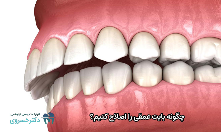 اصلاح بایت عمقی
