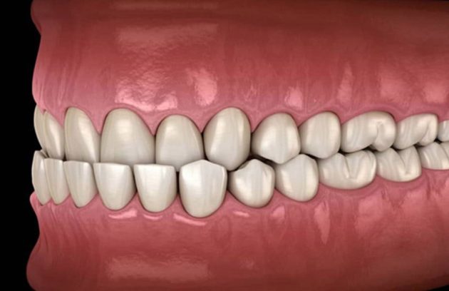 راهکار درمانی کراس بایت