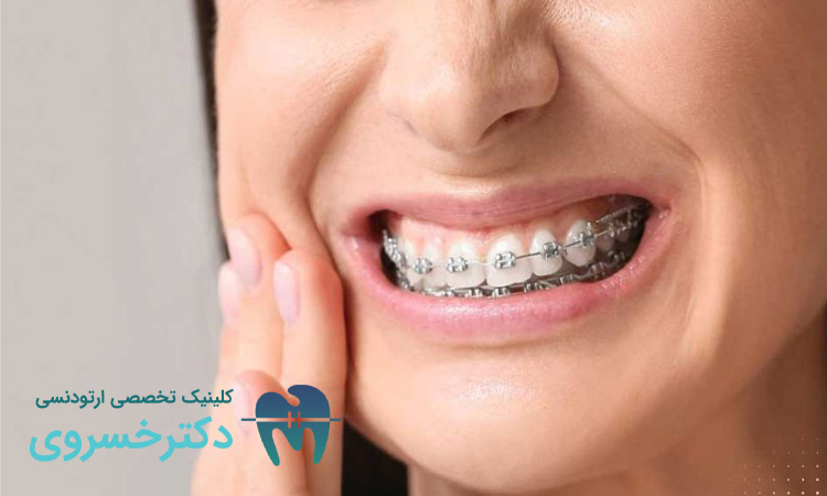 راهکارهای کاهش درد ارتودنسی