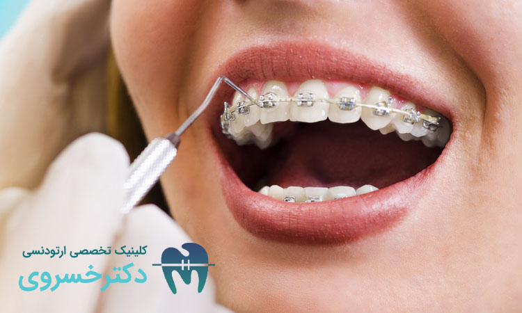 بررسی ارتودنسی دو مرحلهای