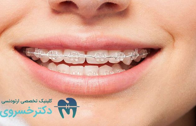 زمان مناسب ارتودنسی پیشگیرانه