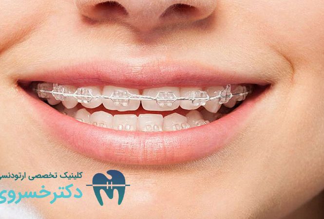 زمان مناسب ارتودنسی پیشگیرانه
