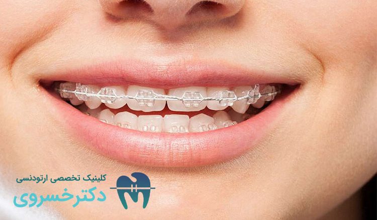 زمان مناسب ارتودنسی پیشگیرانه