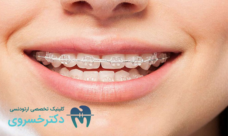 زمان مناسب ارتودنسی پیشگیرانه