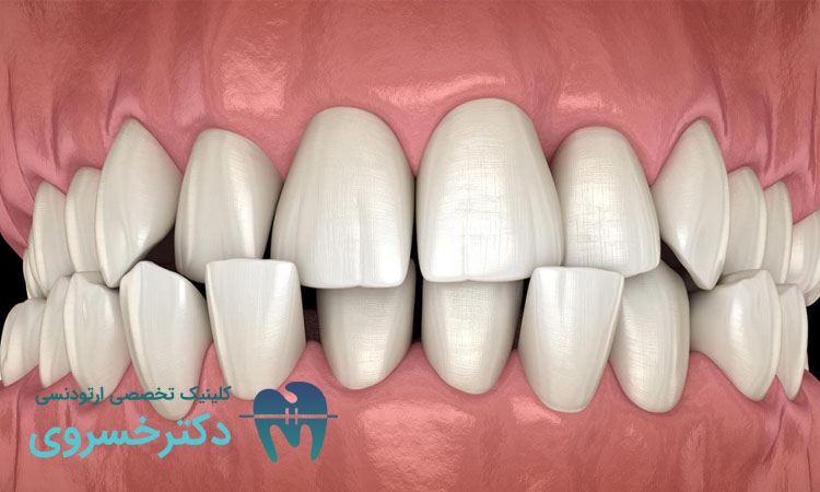 اهمیت تشخیص زودهنگام مالاکلوژن