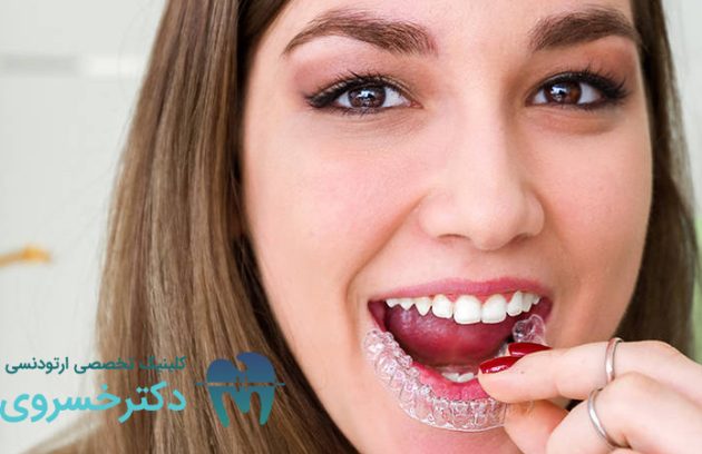 انواع مال‌اکلوژن