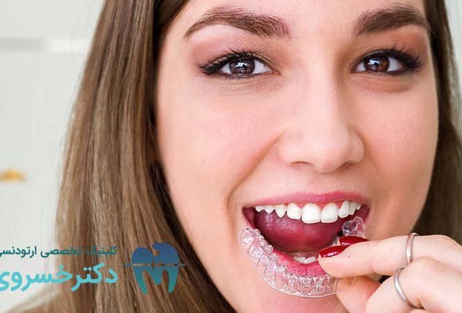 انواع مال‌اکلوژن