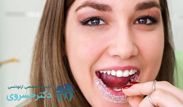 انواع مال‌اکلوژن