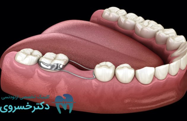 دلایل کشیدن دندان برای ارتودنسی