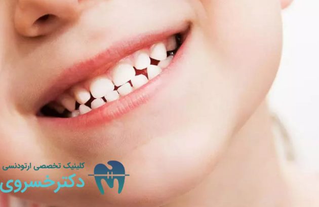 درمان سندروم فقدان دندان