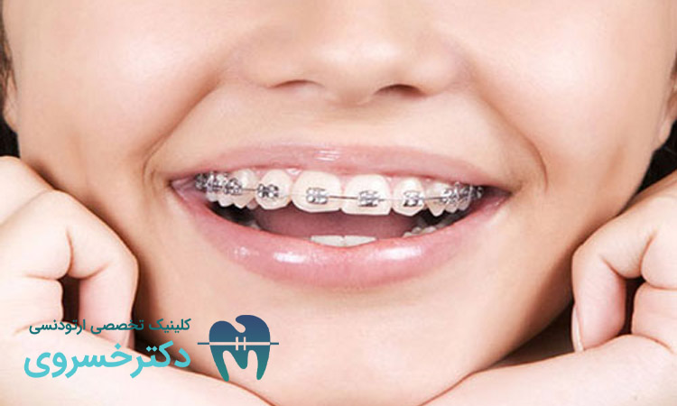 ارتودنسی پیشگیرانه و تأثیر آن بر آینده دندانی