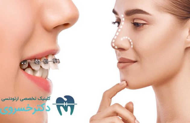 ارتودنسی و جراحی بینی