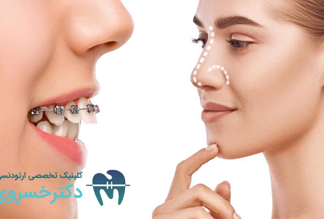 ارتودنسی و جراحی بینی