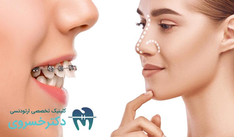 ارتودنسی و جراحی بینی