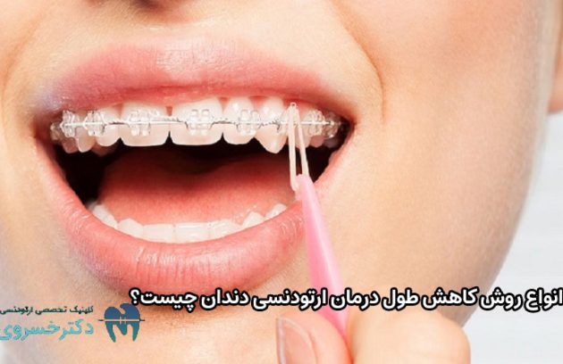 انواع روش کاهش طول درمان ارتودنسی دندان