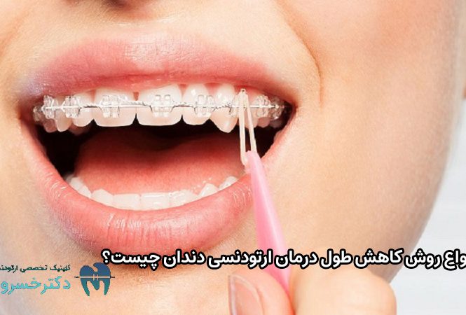 انواع روش کاهش طول درمان ارتودنسی دندان