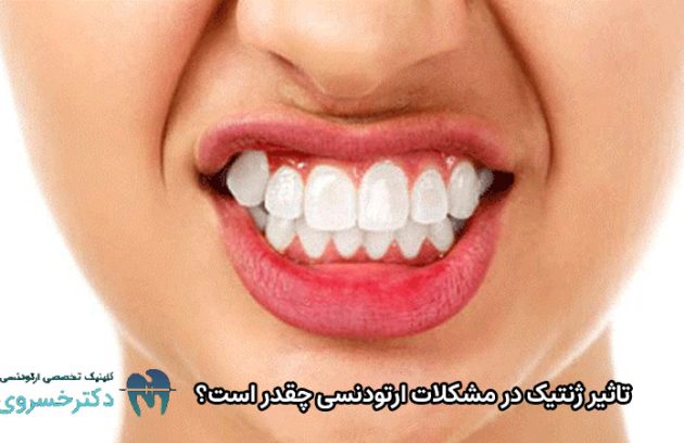 تاثیر ژنتیک در مشکلات ارتودنسی